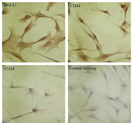 图1:A:Brd-U、B:CD44、C:CD34、D:控制覆盖