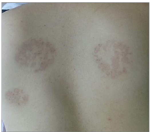 Şekil 3: Healed yakılan alanları en az kıkır kıkırık kıkırık kıkırık bölgelerle yaktı