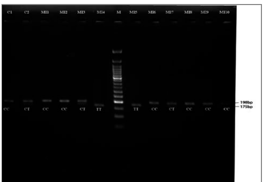 Figure 1: Gel electrophoresis showing RFLP. C1 and C2 are con-trols; MI1 to MI10 are Male infertile samples; M-50bp molecular marker.