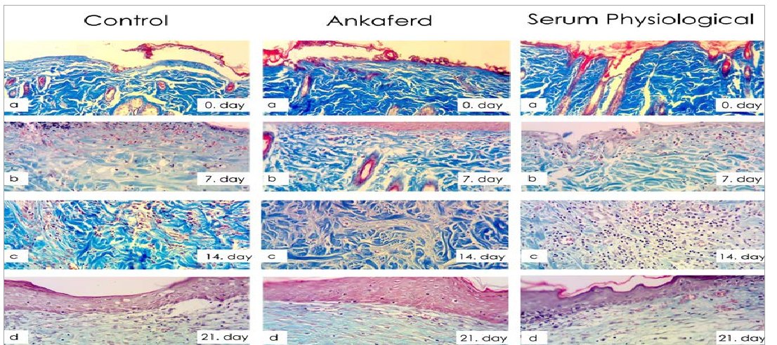 图3:控制组织图象;图-4. Ankaferd组织图象;图-5.Serum 物理-逻辑组组织图象;