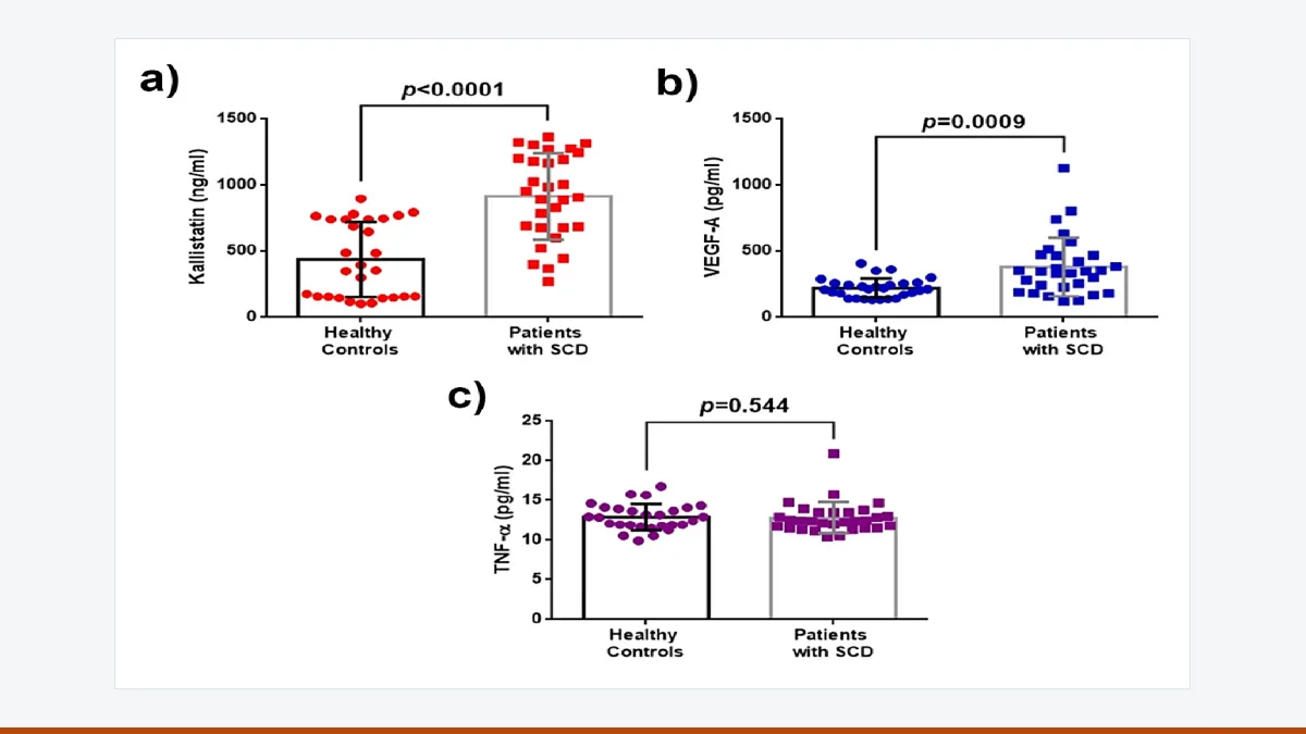 Dot plots comparing serum kallistatin, VEGF-A and TNF-alpha in healthy controls and patients with sickle cell disease.